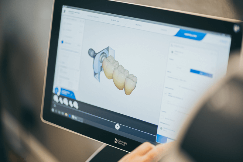 CEREC mit digitalem Fertigungsweg bei Zahnarzt Kiel - Klaas Köppe