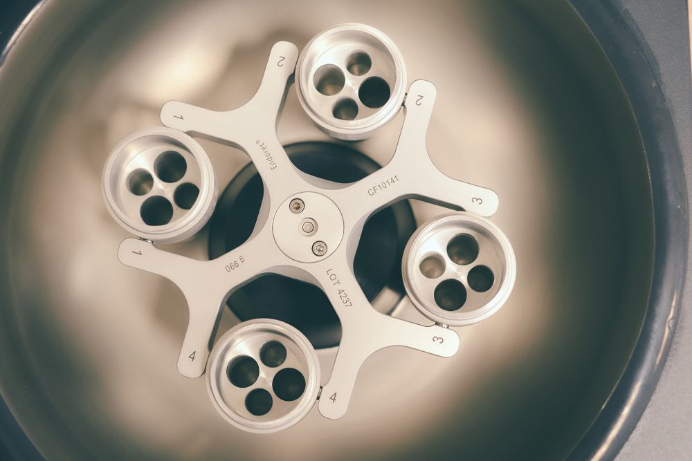 Knochenaufbau für die Implantologie und Parodontologie bei Zahnarzt Kiel - Klaas Köppe