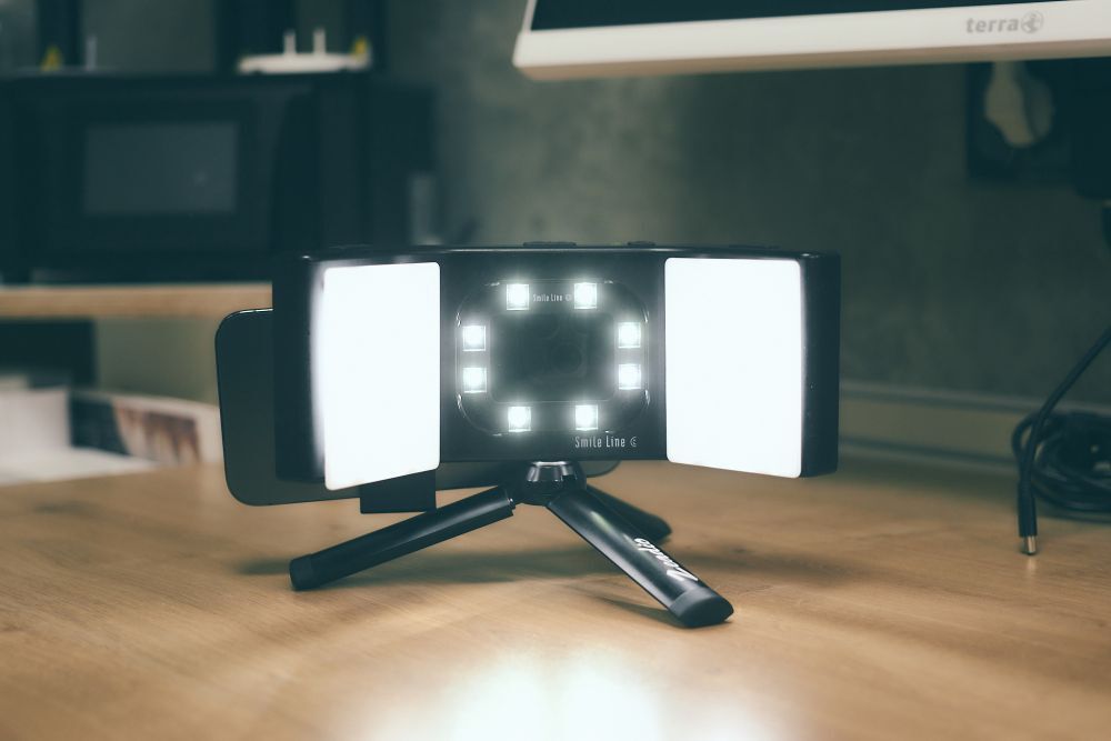 Dentalfotografie bei Zahnarzt Kiel - Klaas Köppe